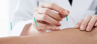 Viddha Karma Thane - Marma Needle Therapy